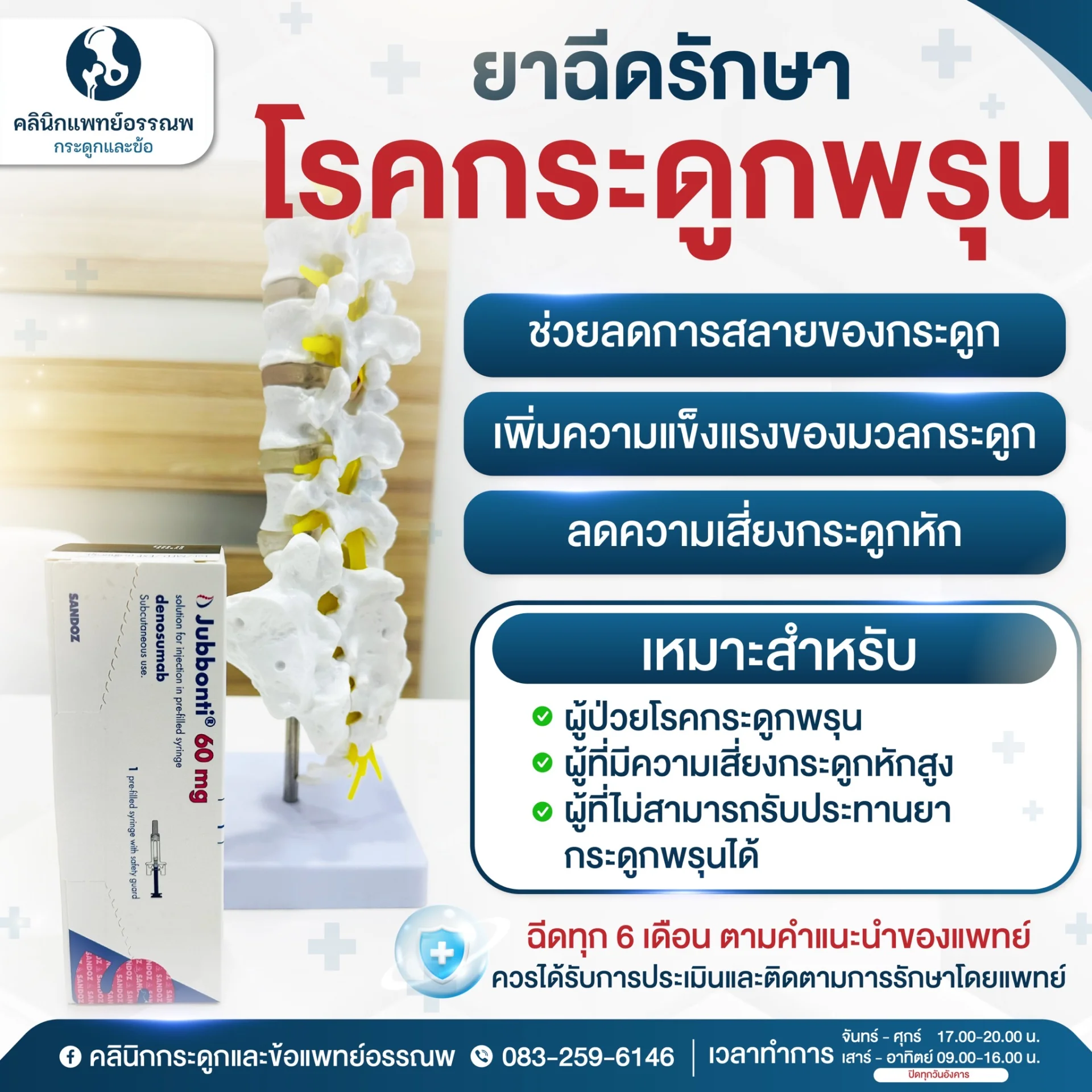อินโฟกราฟิกแสดง 4 ระยะของข้อเข่าเสื่อม